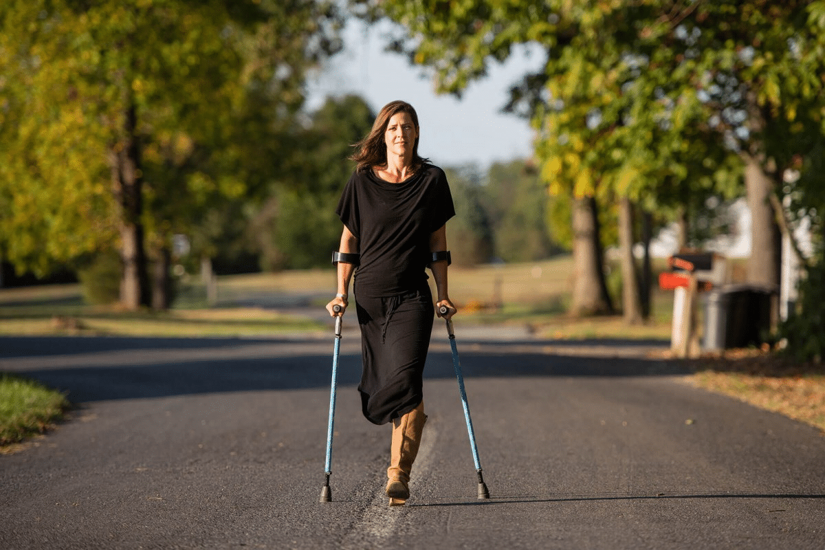 Essential Amputee Meaning: Definition And Explanation