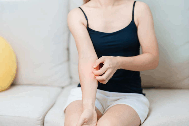 Allergic to Benadryl? Critical Signs