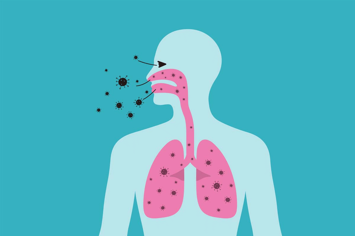 Cold or Bronchitis? Critical Symptoms Guide
