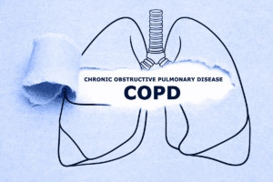 Profound Manage COPD Common Cold: Safe Relief Options