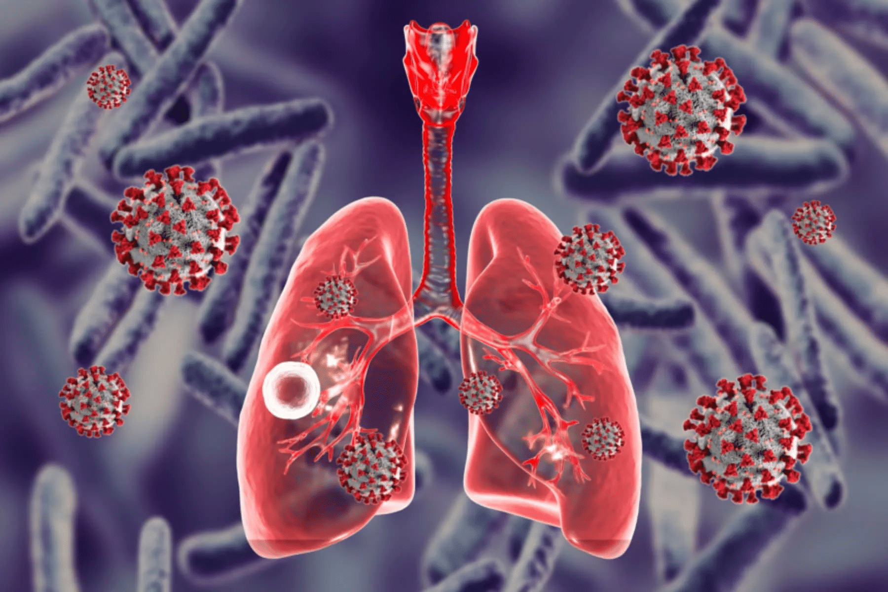 Is Pneumonia Contagious? Vital Safety Facts