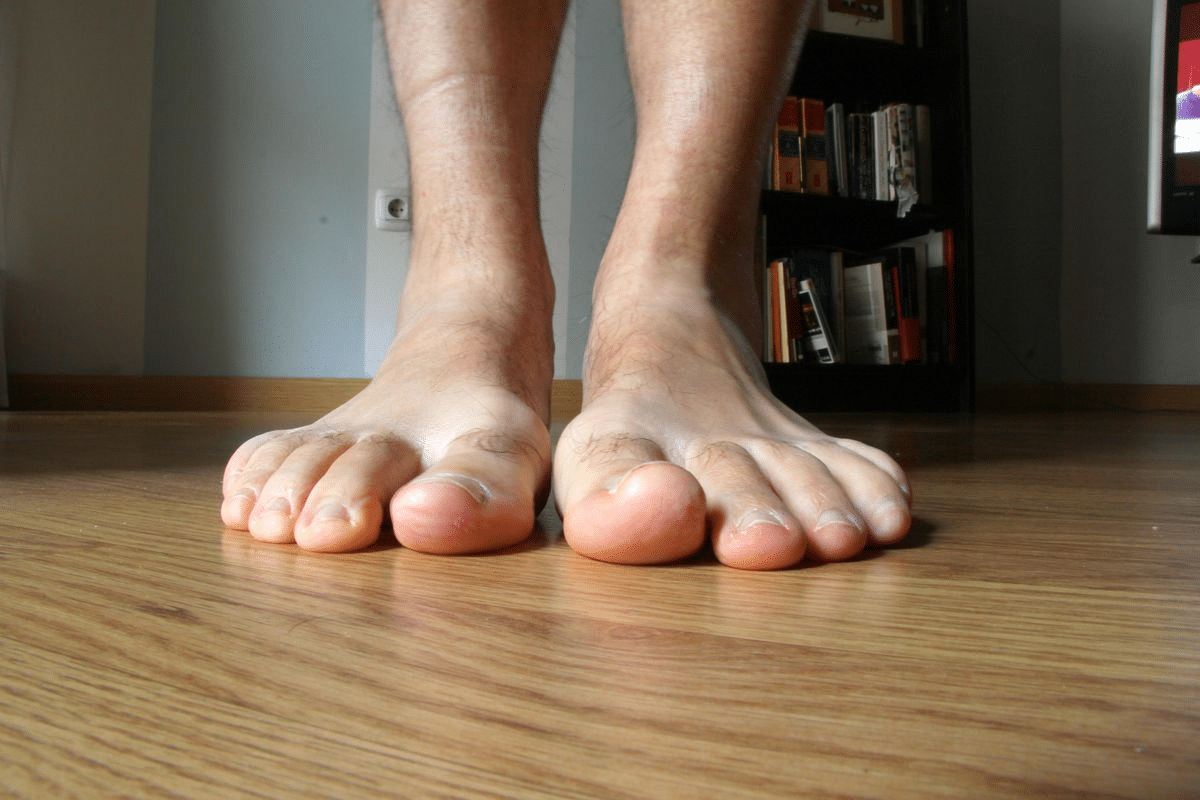 Key Why Does COPD And Water Retention Cause Swollen Feet And Edema?