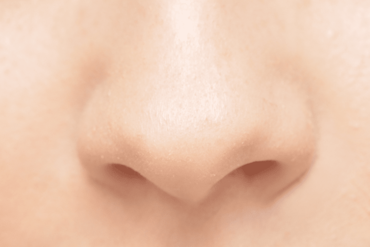 Profound Why Do I Have A Runny Nose: Causes & Solutions