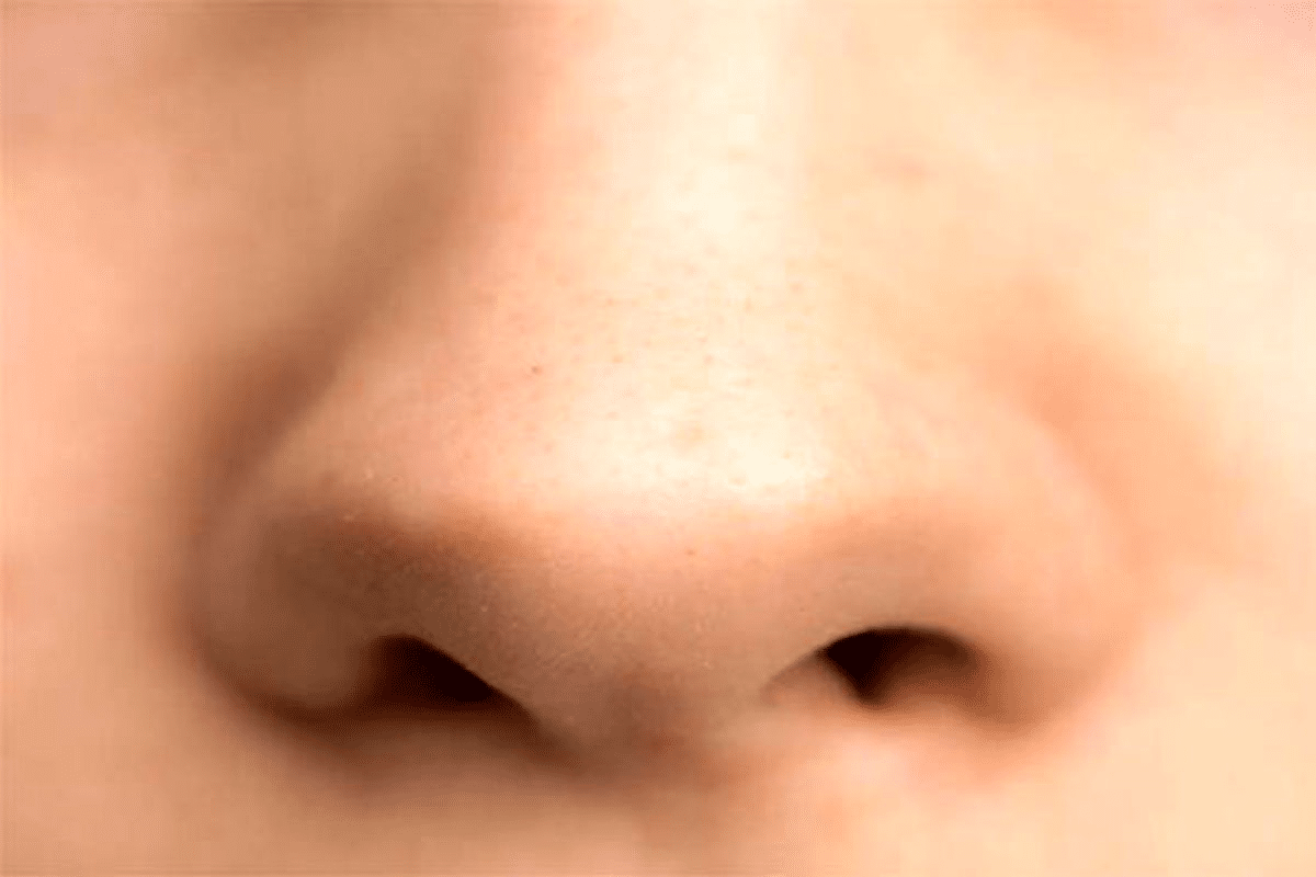 Essential Causes Of Why Is My Nose Stopped Up Explained