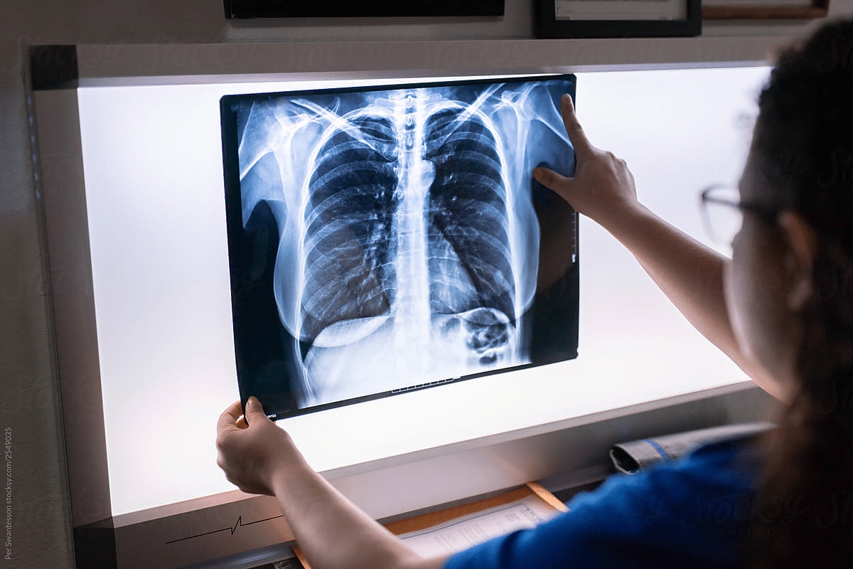 Ultimate 5 Abnormal Lung CT Scan Findings Guide