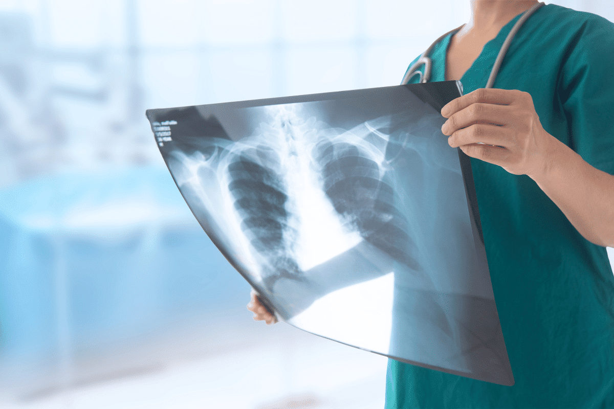 Amazing What Does A Healthy Lung Xray Look Like?