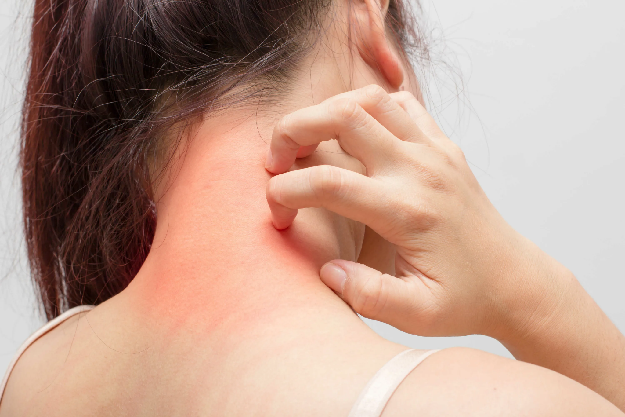 Rash with Asthma: Causes and Safe Relief