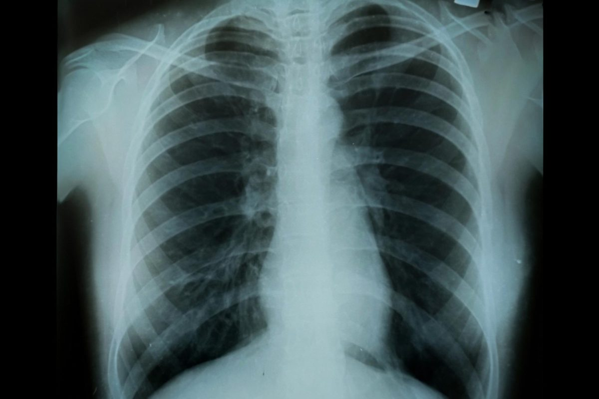 Ultimate 4 COPD Categories: GOLD Guide 3 Ultimate 4 COPD Categories: GOLD Guide