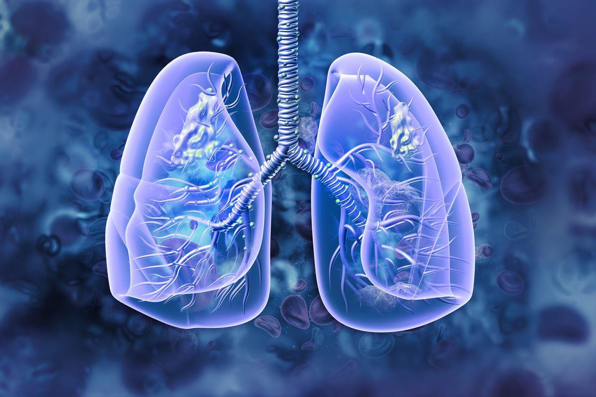 Is COPD Painful Death? Honest Facts