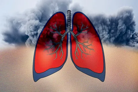 Profound Does Smoking Cause Bronchitis? Vital Facts