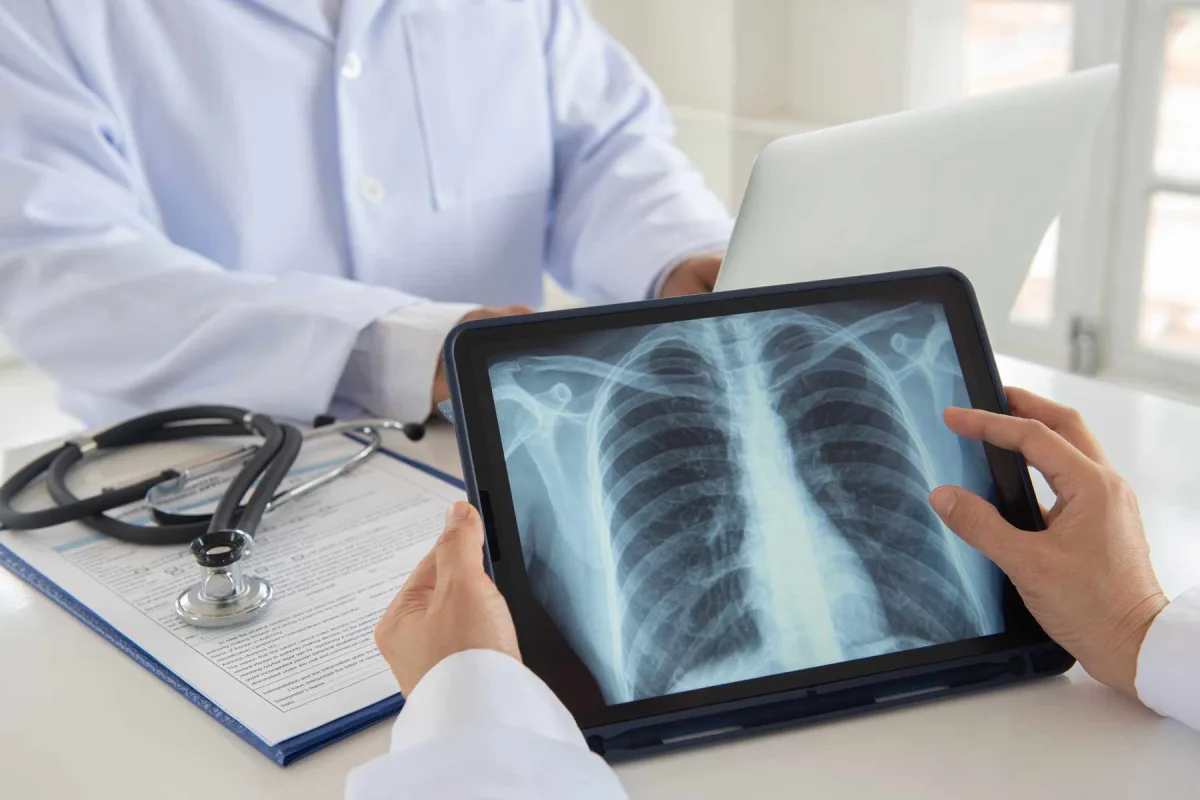 Sharp What Can Be Diagnosed With A Chest X Ray?