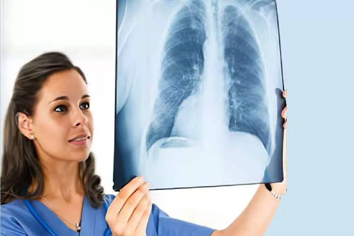 Ultimate Unhealthy Healthy Lung Xray Comparison