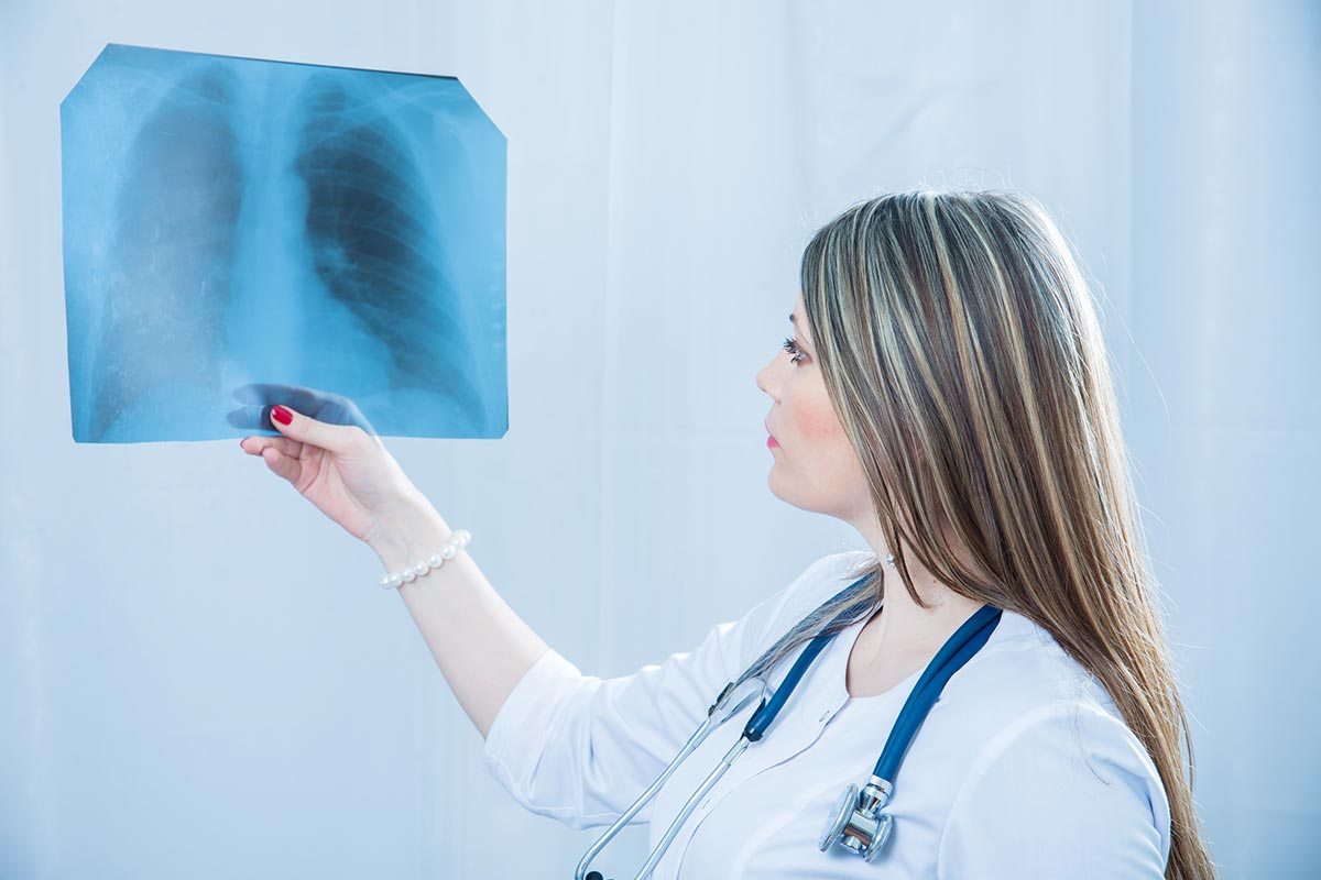 How Long Does Bronchitis Last? Vital Facts
