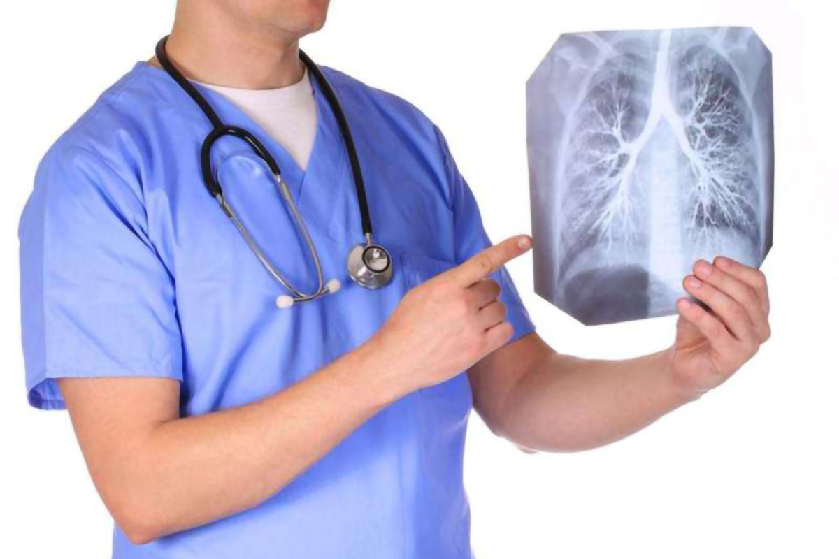 How Long Does Bronchitis Last? Vital Facts