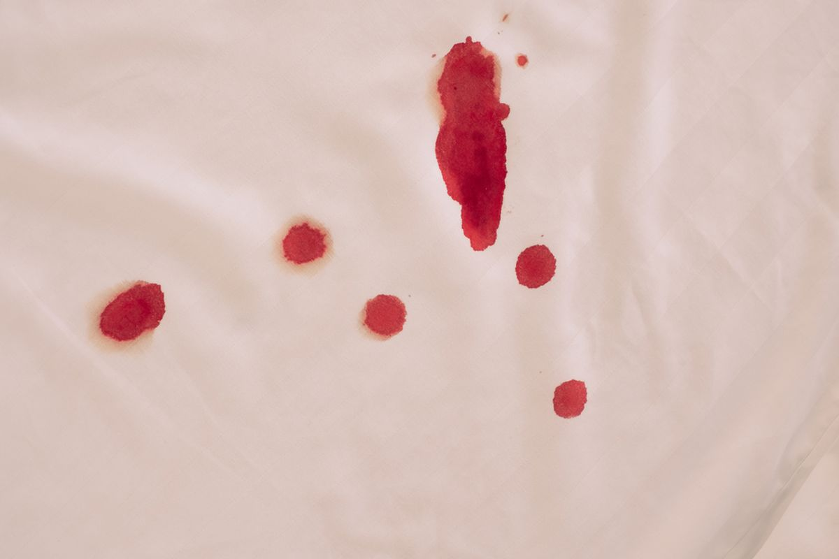 Why Does My Mucus Have Blood in It? Critical