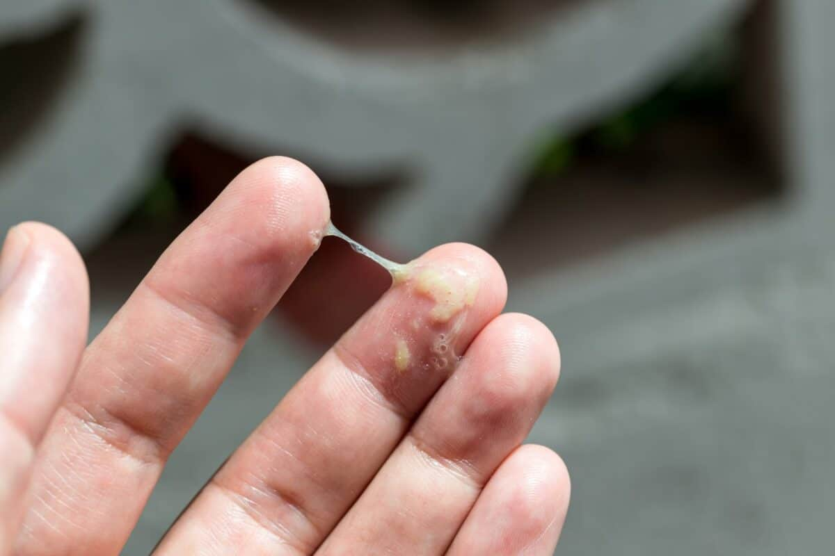 What Does It Mean If U Cough Up Blood?