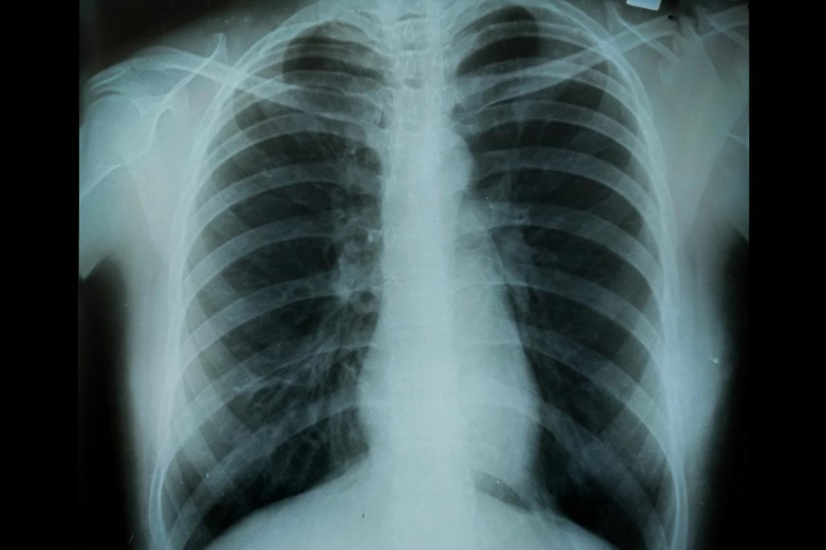 Essential Causes Of Discomfort When Breathing Deeply