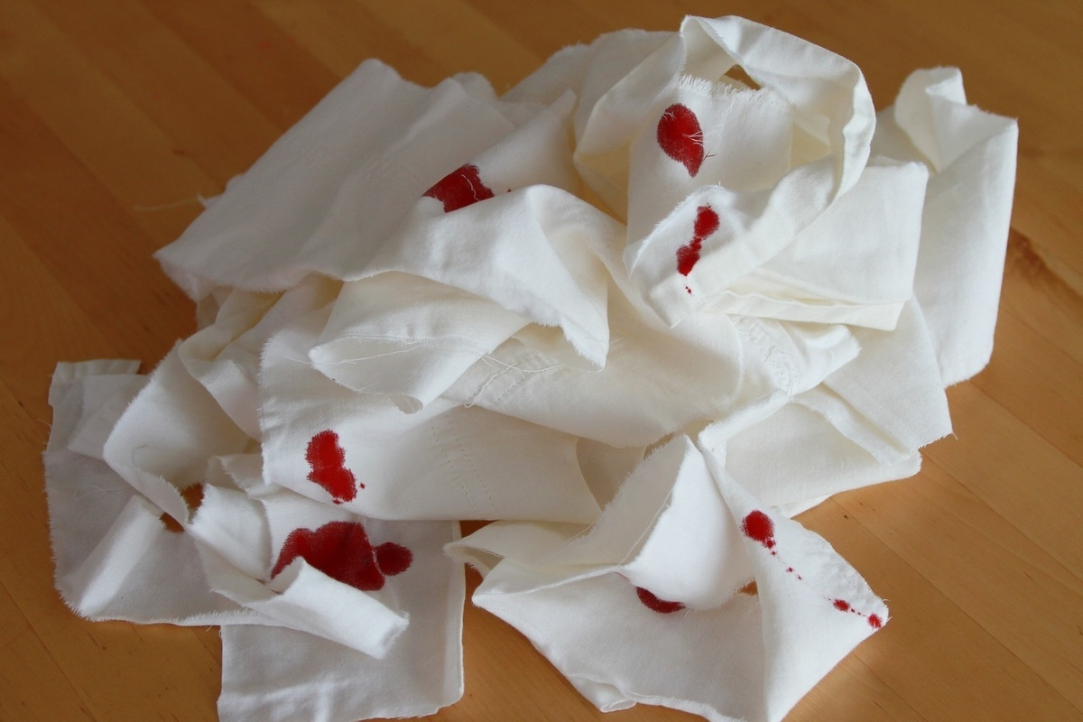 Why Is There Blood in My Mucus? Critical 1 Why Is There Blood in My Mucus? Critical