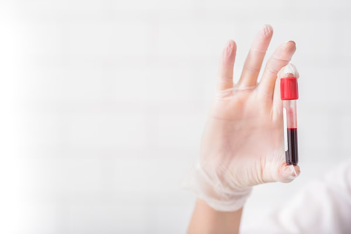 Blood in Phlegm: 5 Critical Causes