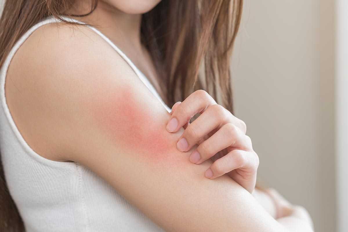 Allergic Reaction Around Eyes: Care