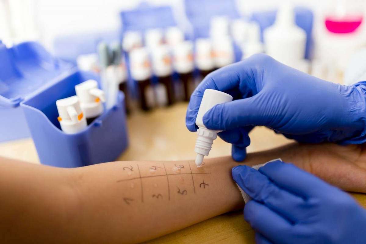 Is Blood Test Needed for Allergies? Facts