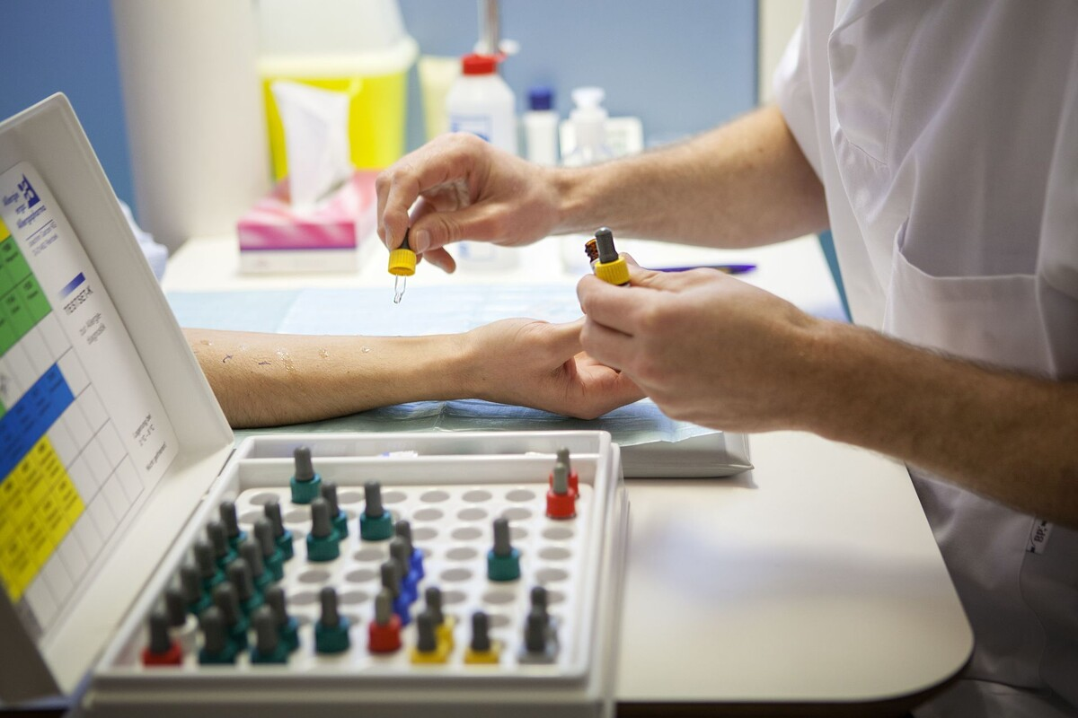 Allergy Skin Test Positive: Vital Next Steps