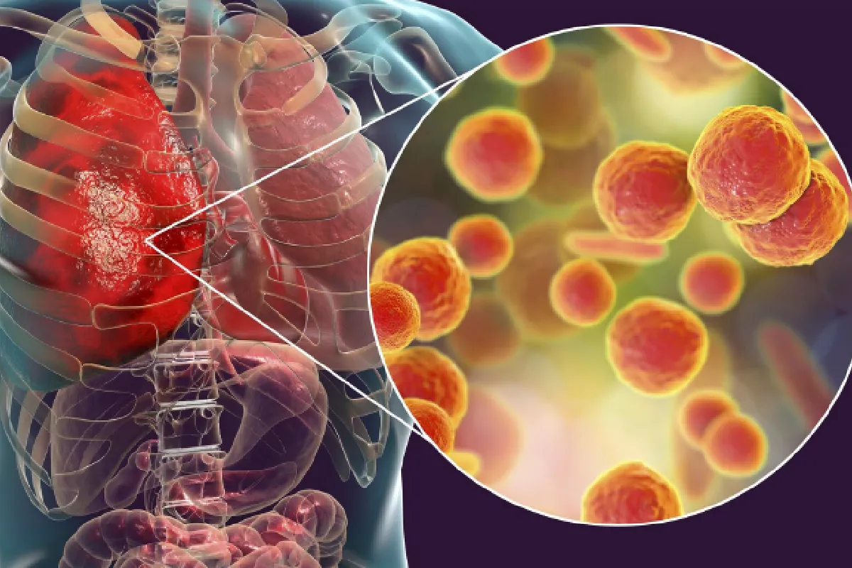 Profound 5 Best OTC Chest Congestion Medication That Work