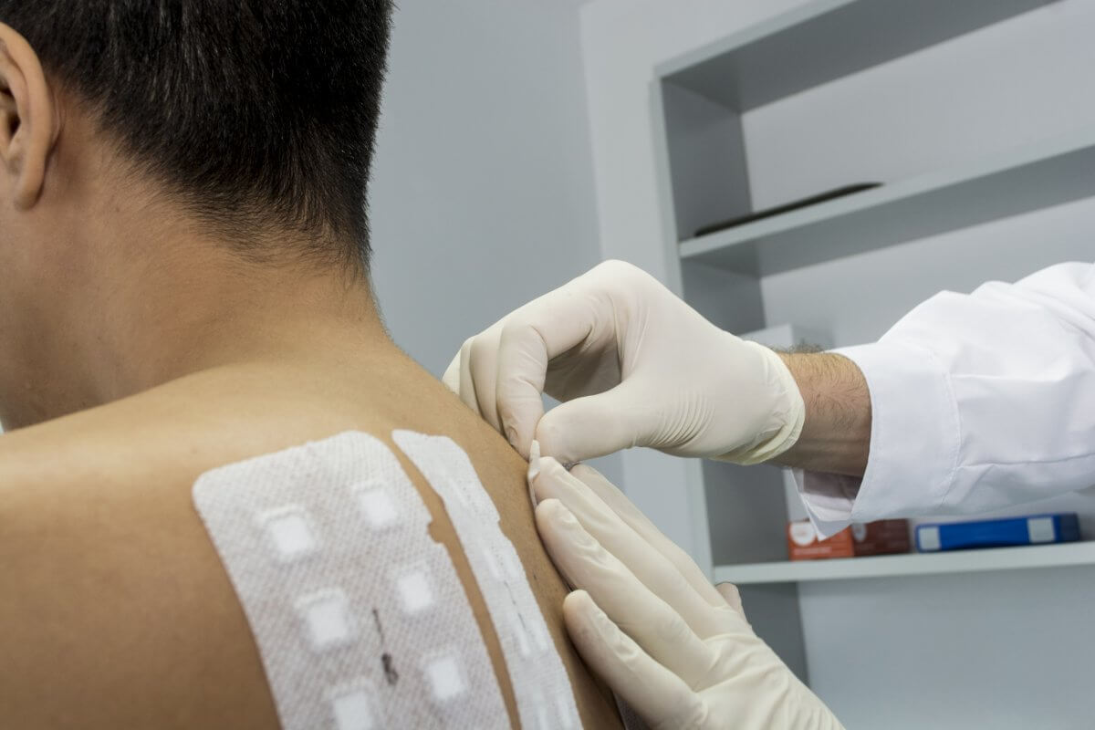 How to Interpret Allergy Test Results: Guide