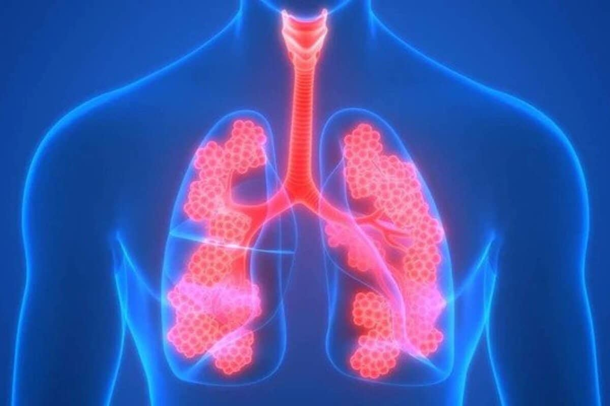 Ultimate 7 Quick Chest Congestion Relief Tips