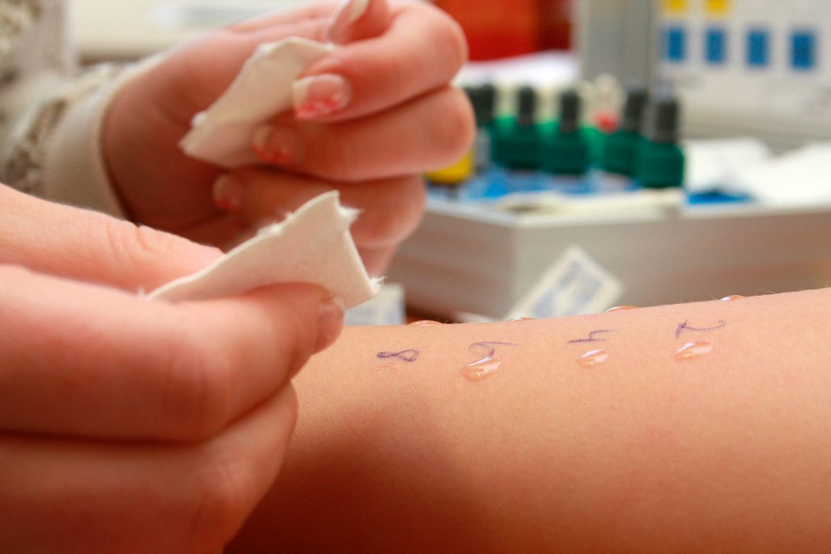 How to Read Allergy Test Results: Guide 2 How to Read Allergy Test Results: Guide