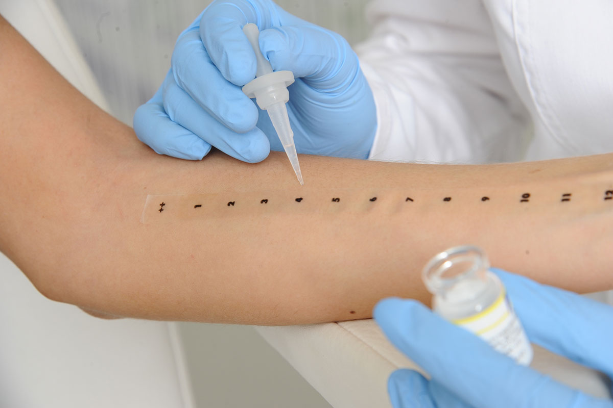 Types of Allergy Testing: 5 Methods