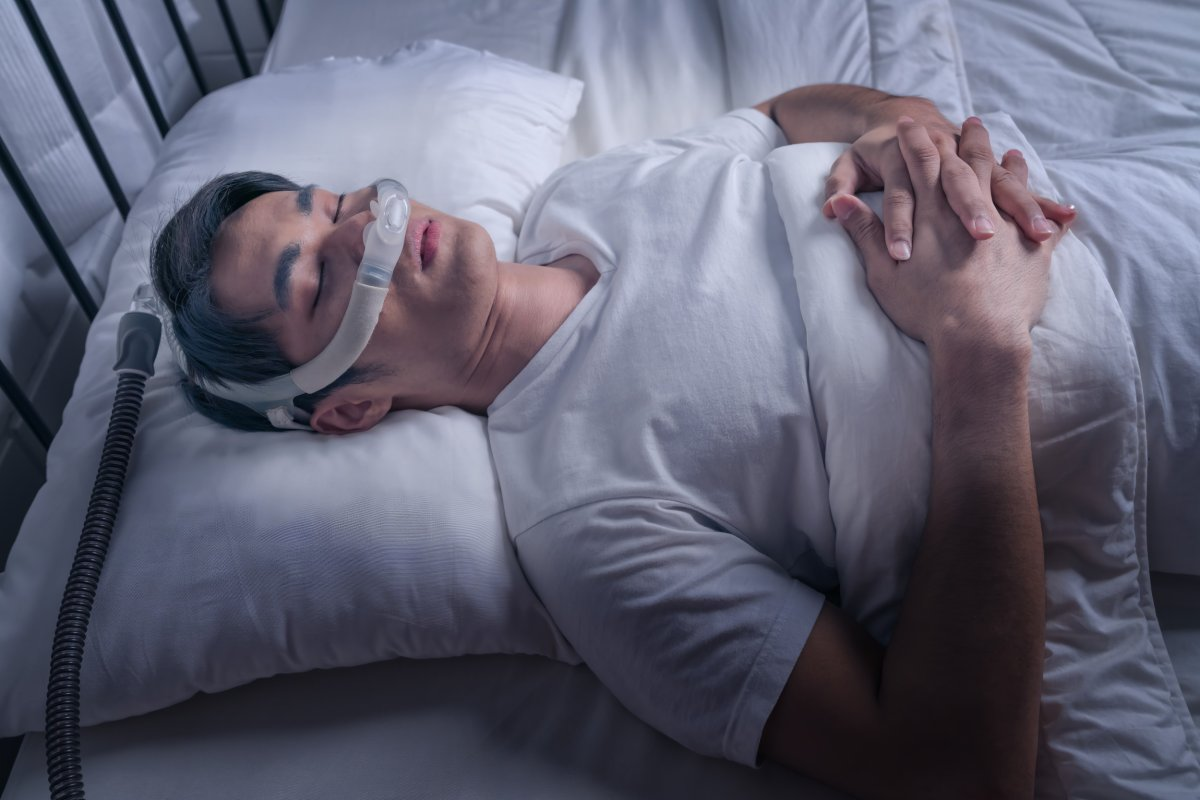 Fascinating Neurological Causes Of Central Sleep Apnea 1 Fascinating Neurological Causes Of Central Sleep Apnea