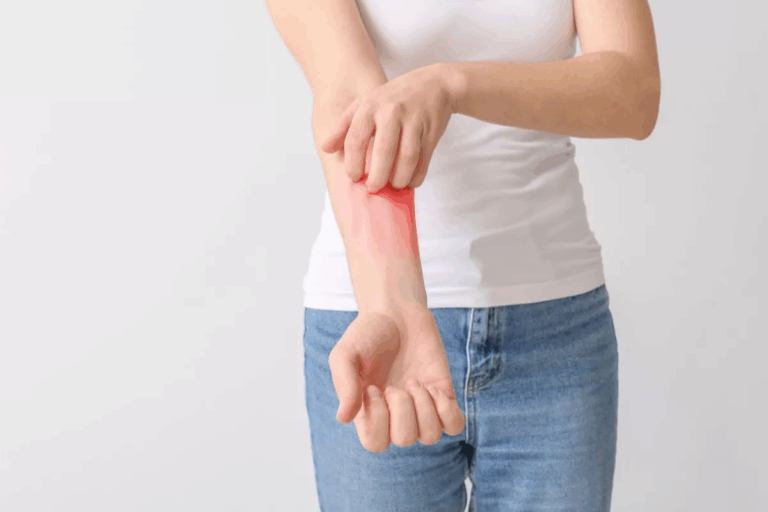 Will Benadryl Help With Itching? Critical Facts
