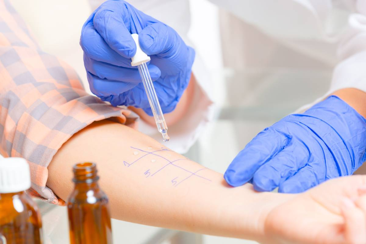 How to Get an Allergy Test: Complete Guide