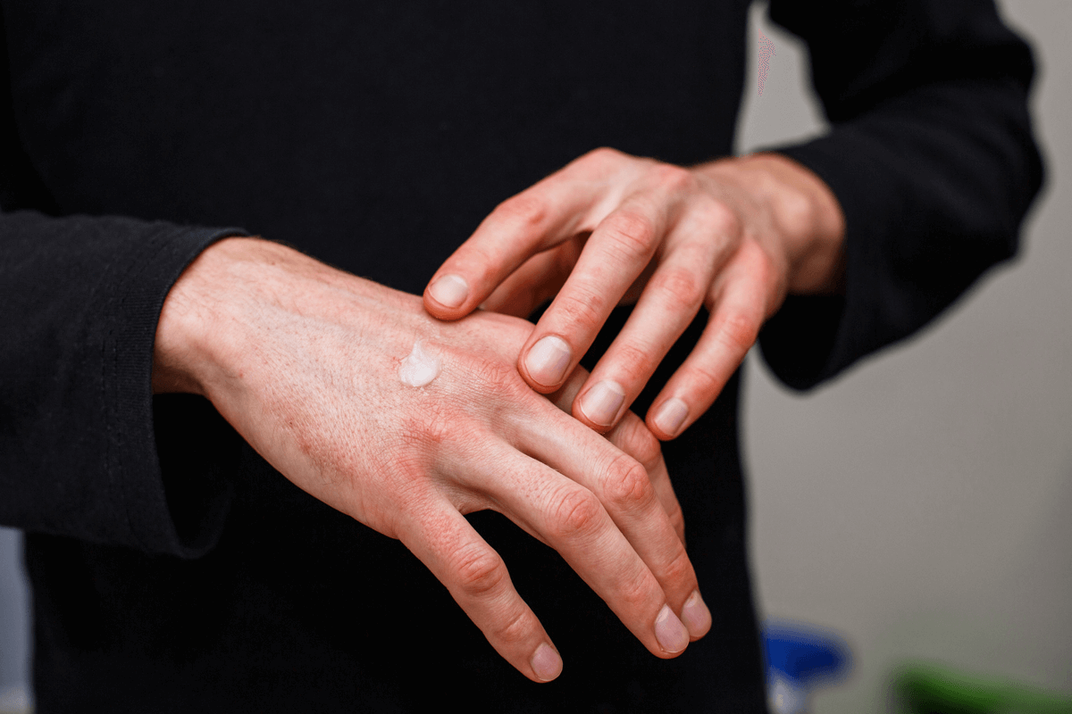 Itchy Skin Rash Ointment: Best Use