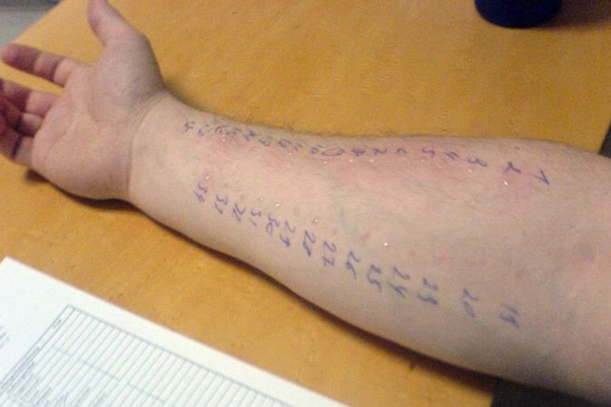 Allergy Panel Test: 7 Best Options Guide