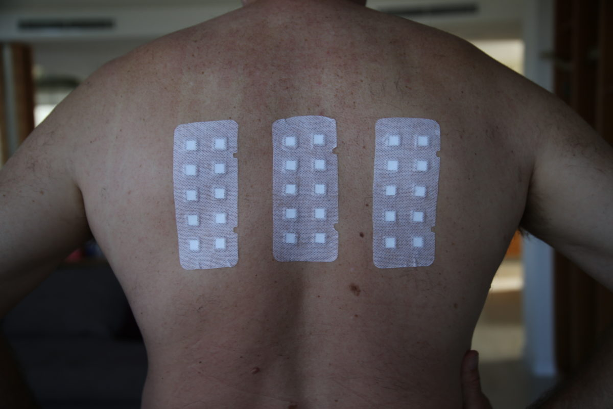 Allergy Testing Skin Test: Best Preparation