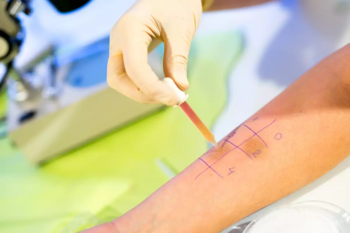 How Long Does Allergy Testing Take? Facts