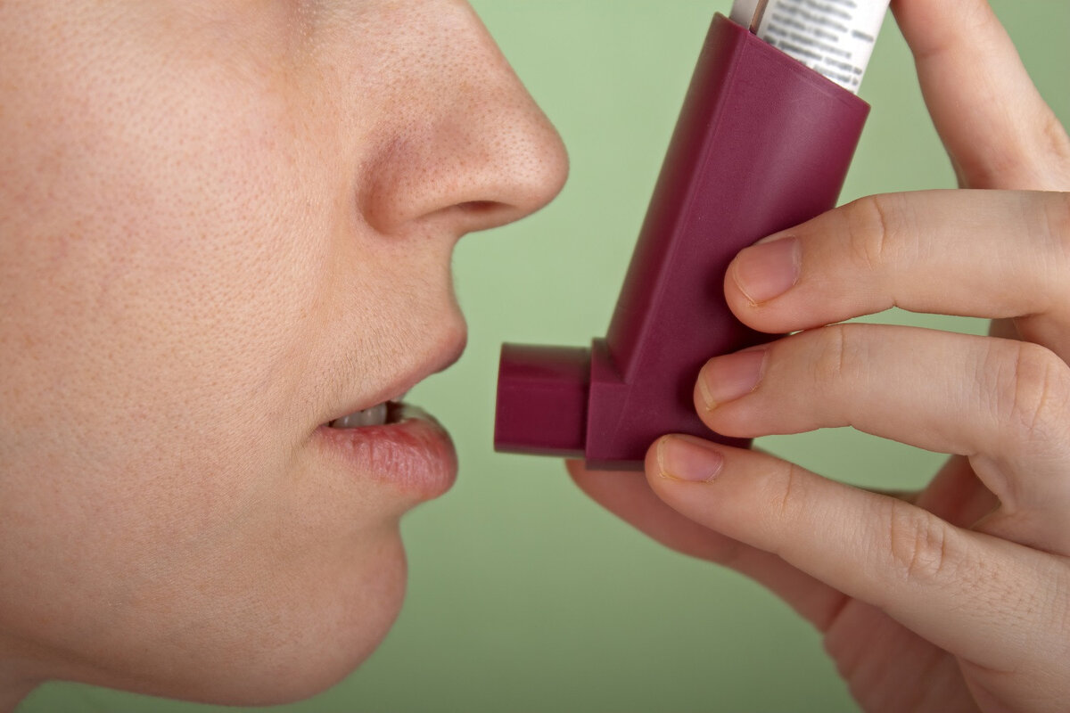 Asthma Stages: 4 Vital Severity Levels