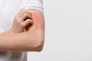 Itch Relief: 7 Proven Methods for Skin