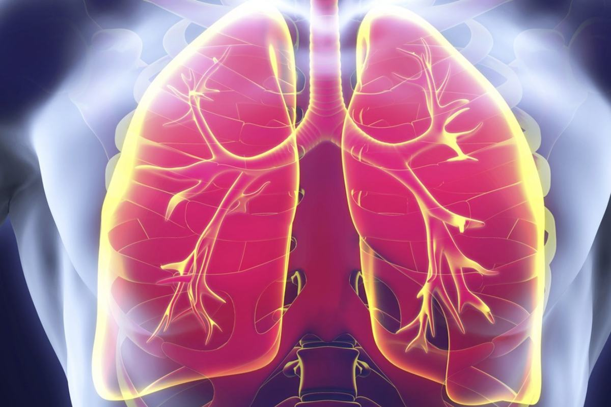 How Does Pneumonia Kill You? 1 How Does Pneumonia Kill You?