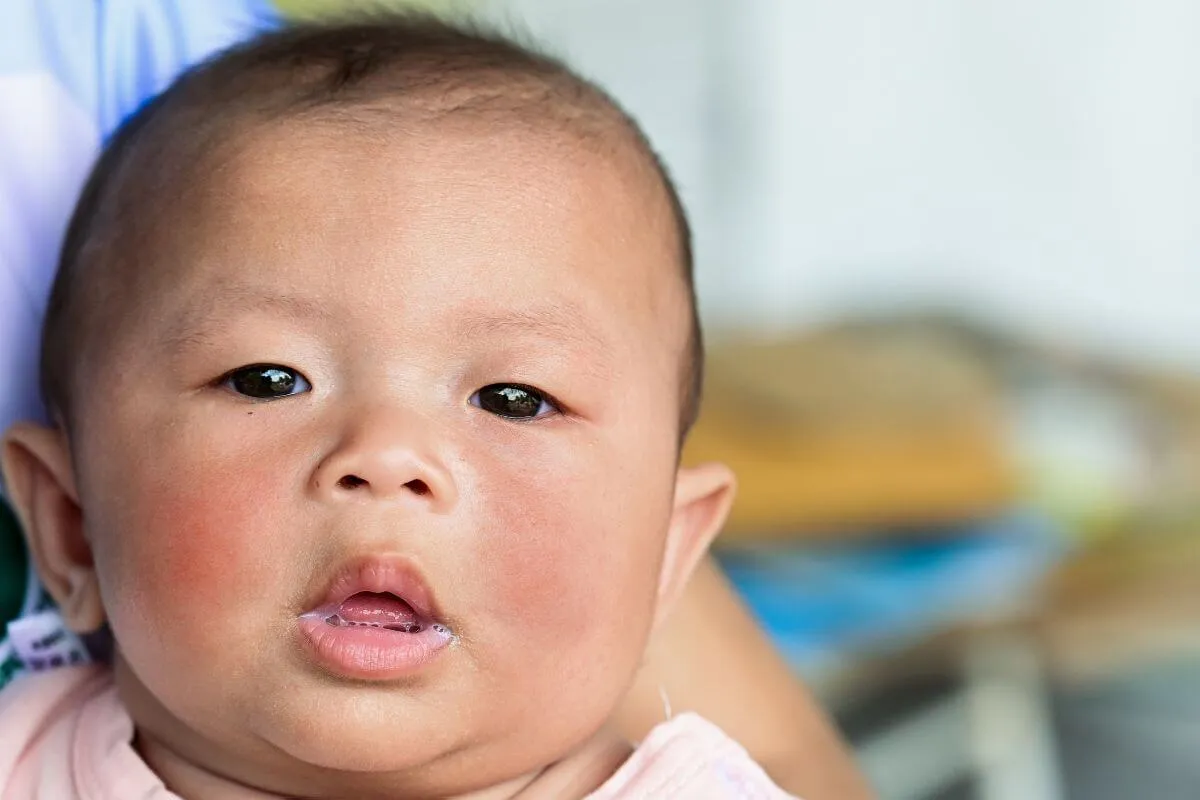 Can Infants Have Allergies? Vital Facts