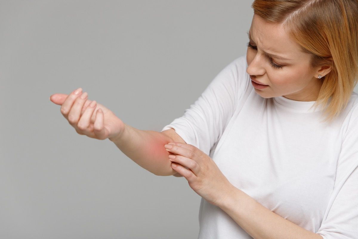 Adhesive Allergy Reaction: Fast Fix