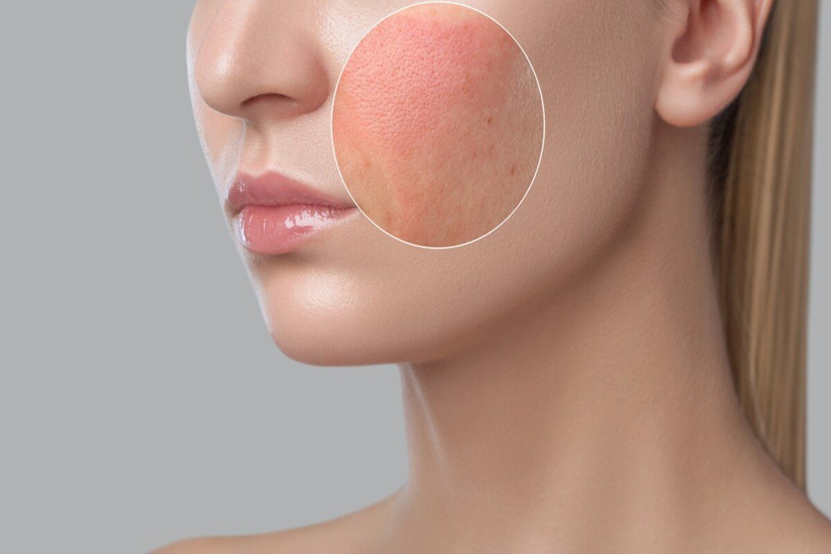 word image 228335 2 LIV Hospital