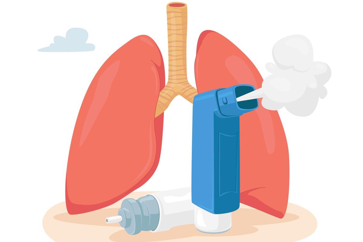 Asthma Pathophysiology: Vital Guide