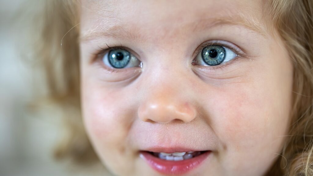 Surgery for Congenital Ptosis 2 surgery for congenital ptosis