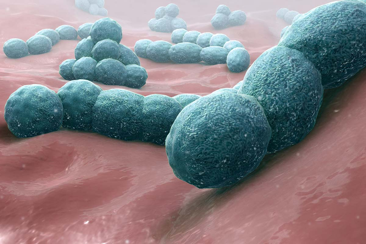 Viral Pneumonia vs Bacterial Pneumonia