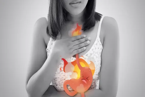 Acid Reflux Cough at Night: Fast Relief