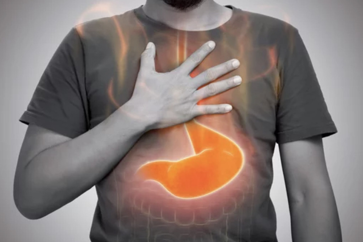 Acid Reflux Cough at Night: Fast Relief