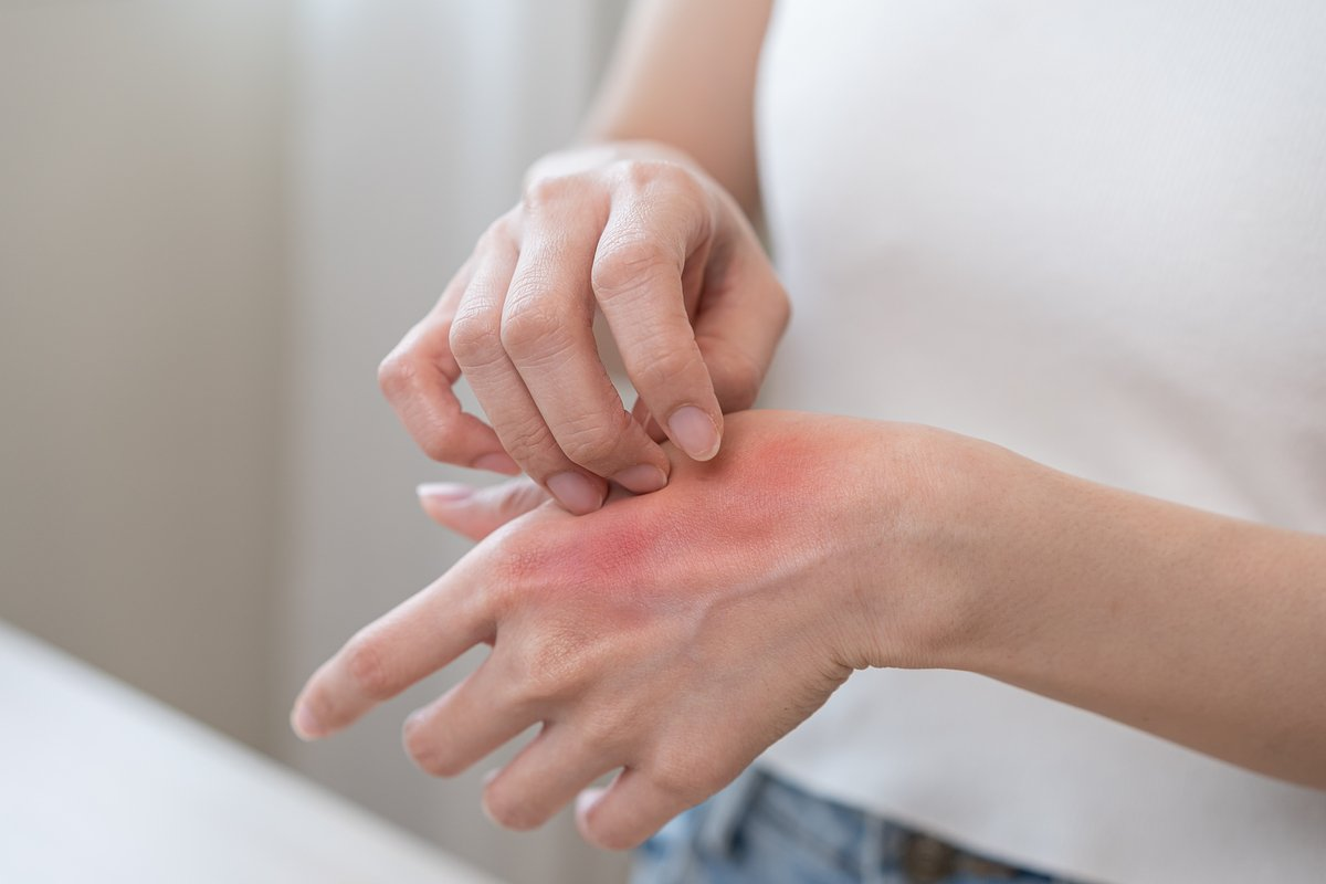 Severe Allergic Reaction: Urgent Signs & Steps